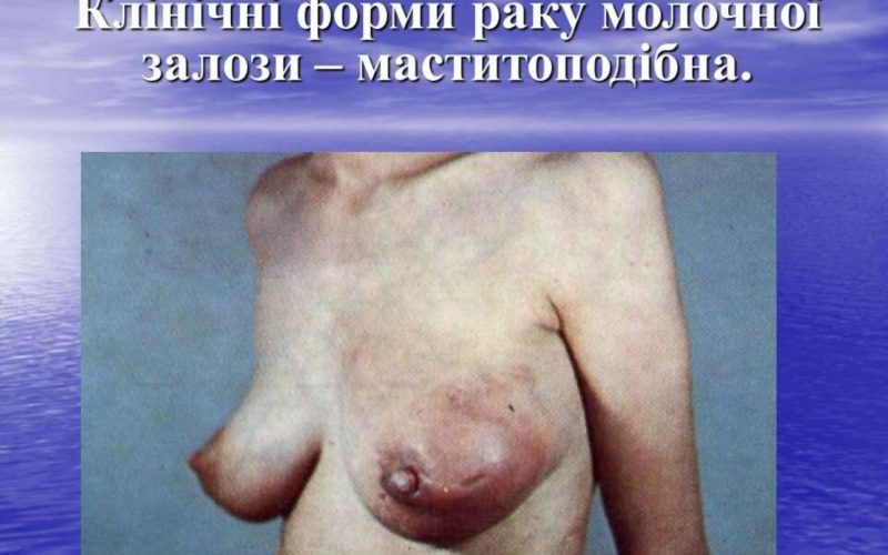 20-zhovtnia-vseukrainskyj-den-borotby-iz-zakhvoriuvanniam-1_page-0010